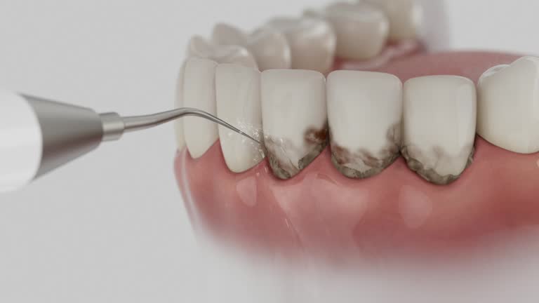 Reliable Dental Implants contractor in Byron, MN by Smile Center Dentistry